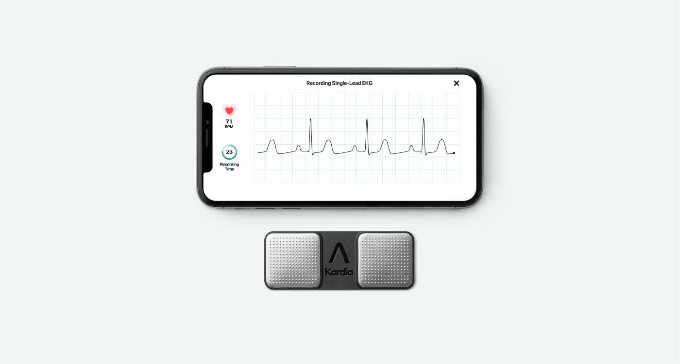 Single lead EKG being taken with KardiaMobile